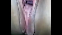 Öffnen Sie die Vagina