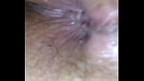 More anal dilation