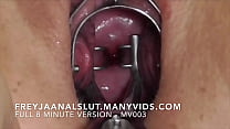 Amador FreyjaAnalslut: Afastamento cervical - Abrindo a boceta de Freyja mostrando seu colo do útero tenso e, em seguida, abrindo o colo de Freyja com um espéculo - versão completa no ManyVids